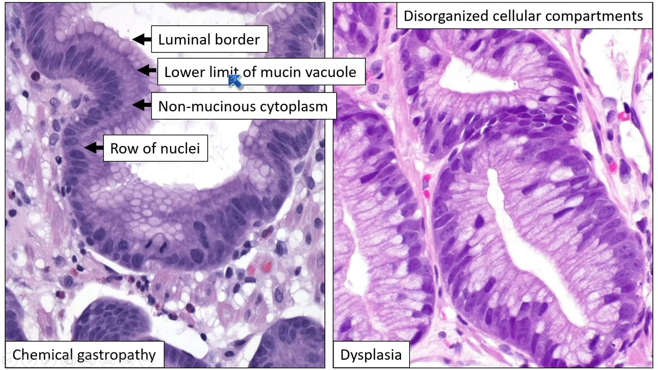 2025 Pathology Review: Practical Updates in Breast, Gastrointestinal and Genitourinary Pathology
