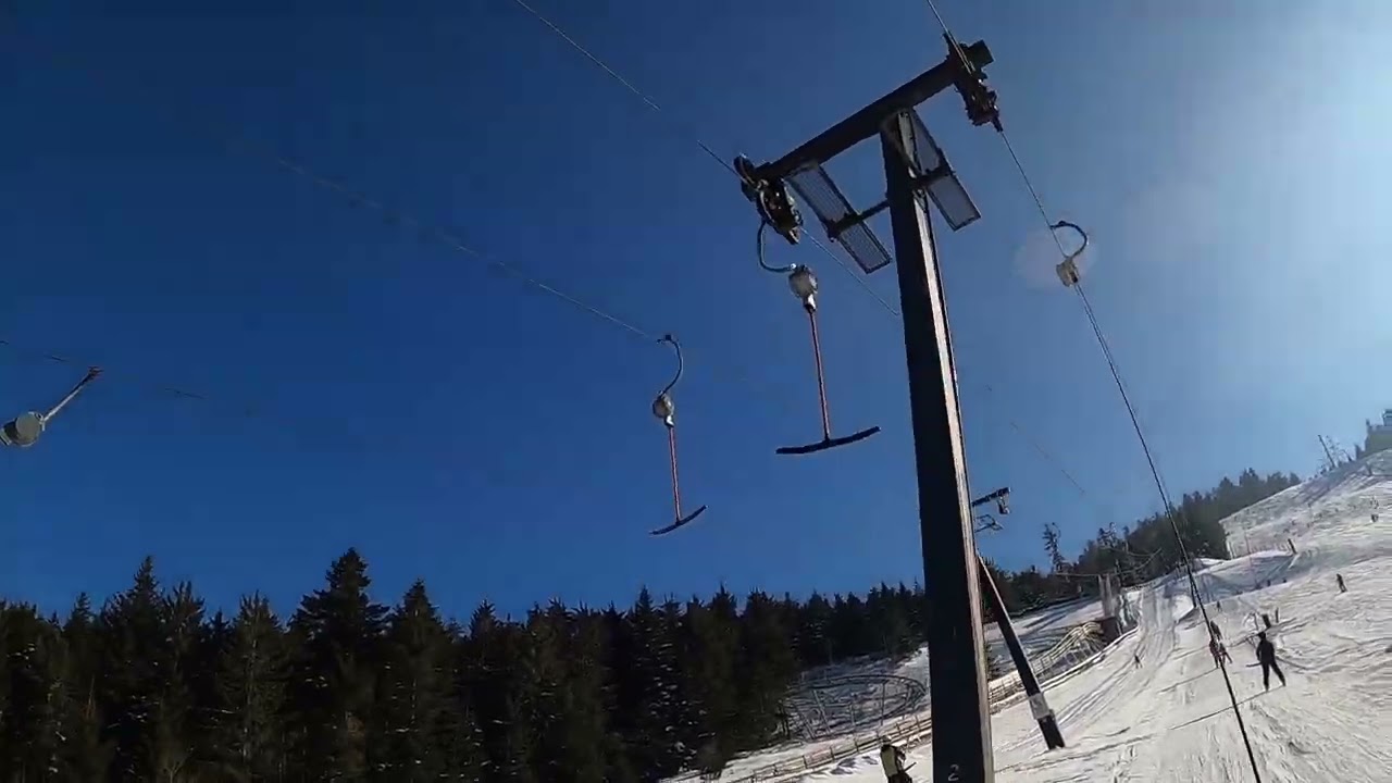 Mehliskopf Lift 3