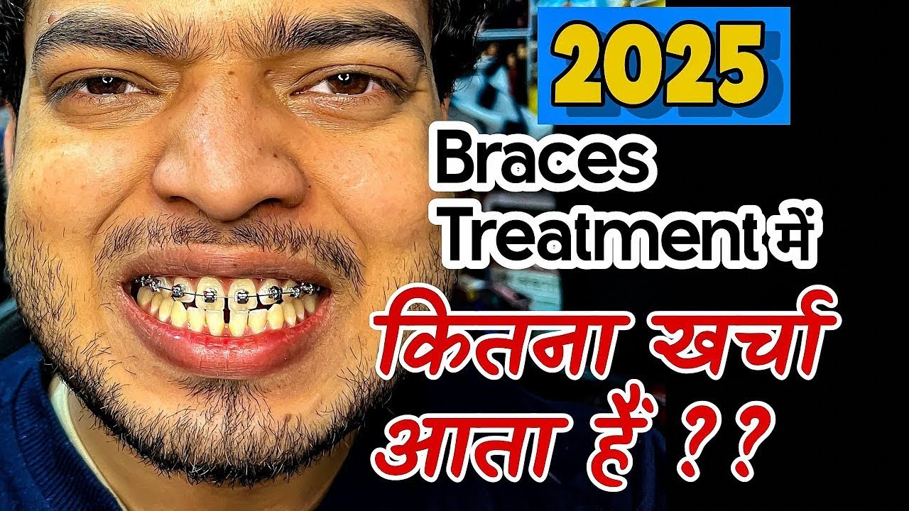 Braces cost in india | Braces cost 2026 | Types of braces | #bracescost #braces #bracesupdate