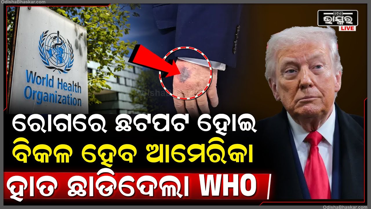 ଟ୍ରମ୍ପଙ୍କୁ ଲାଗିଲା ଶକ୍ତ ଝଟକା ,ଆମେରିକା ହାତ ଛାଡିଦେଲା  WHO Donald Trump
