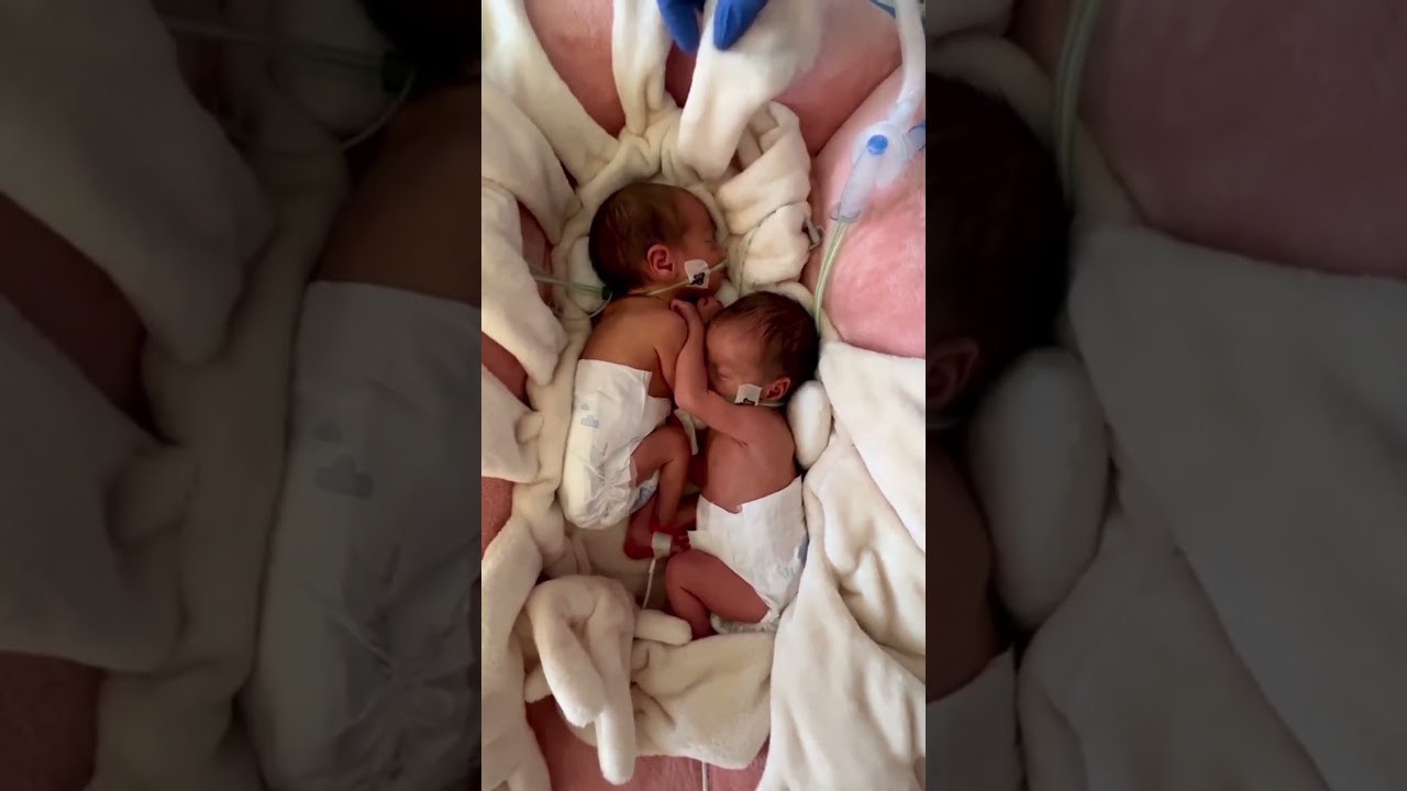 GEMELOS PREMATUROS