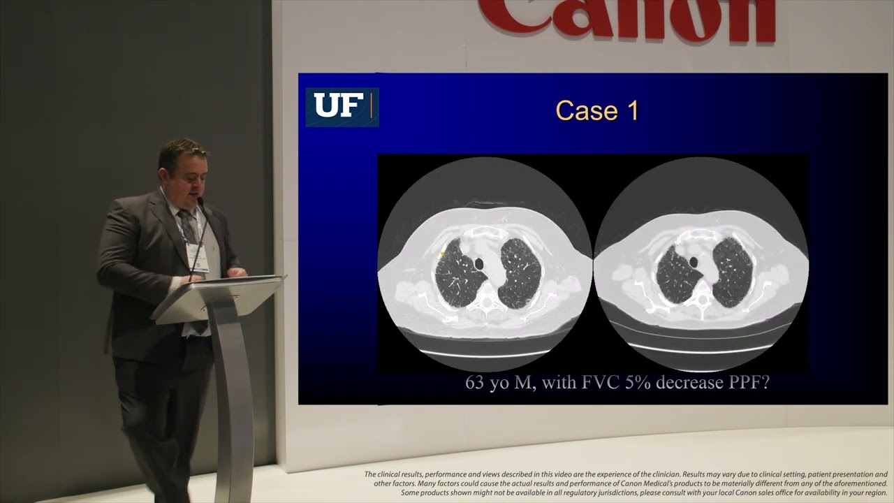 RSNA 2024 Presentation - Bruno Hochhegger, MD, PhD