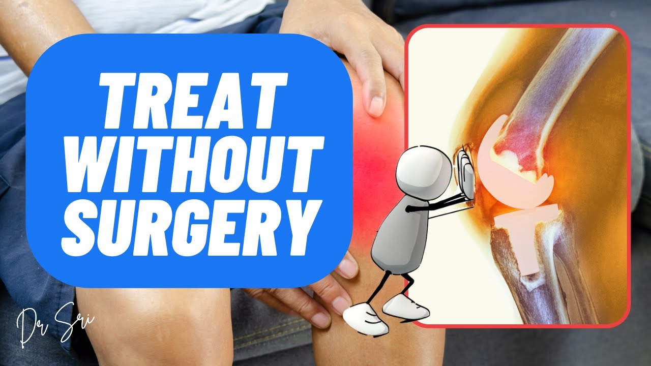 Non-Surgical Osteoarthritis Treatment: Your Complete Guide to Joint Health and Finding Relief