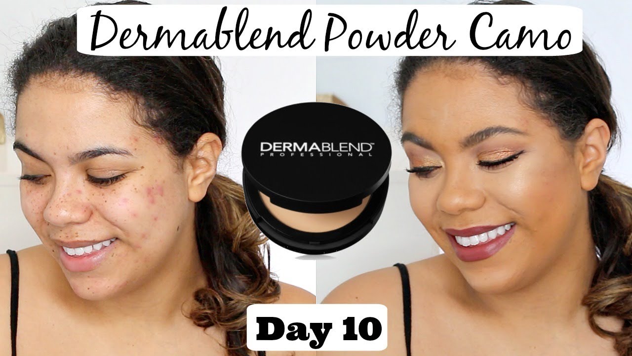 Dermablend Powder Camo Review (oily skin/scarring)