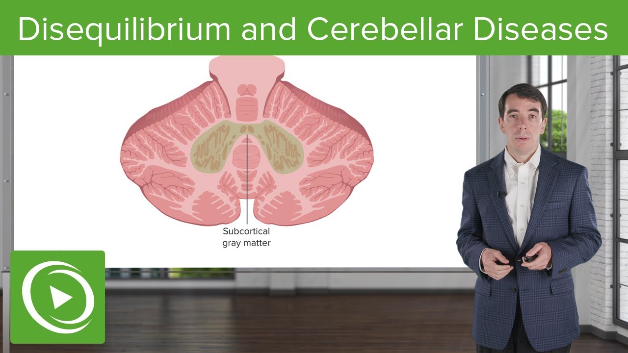 Disequilibrium and Cerebellar Diseases