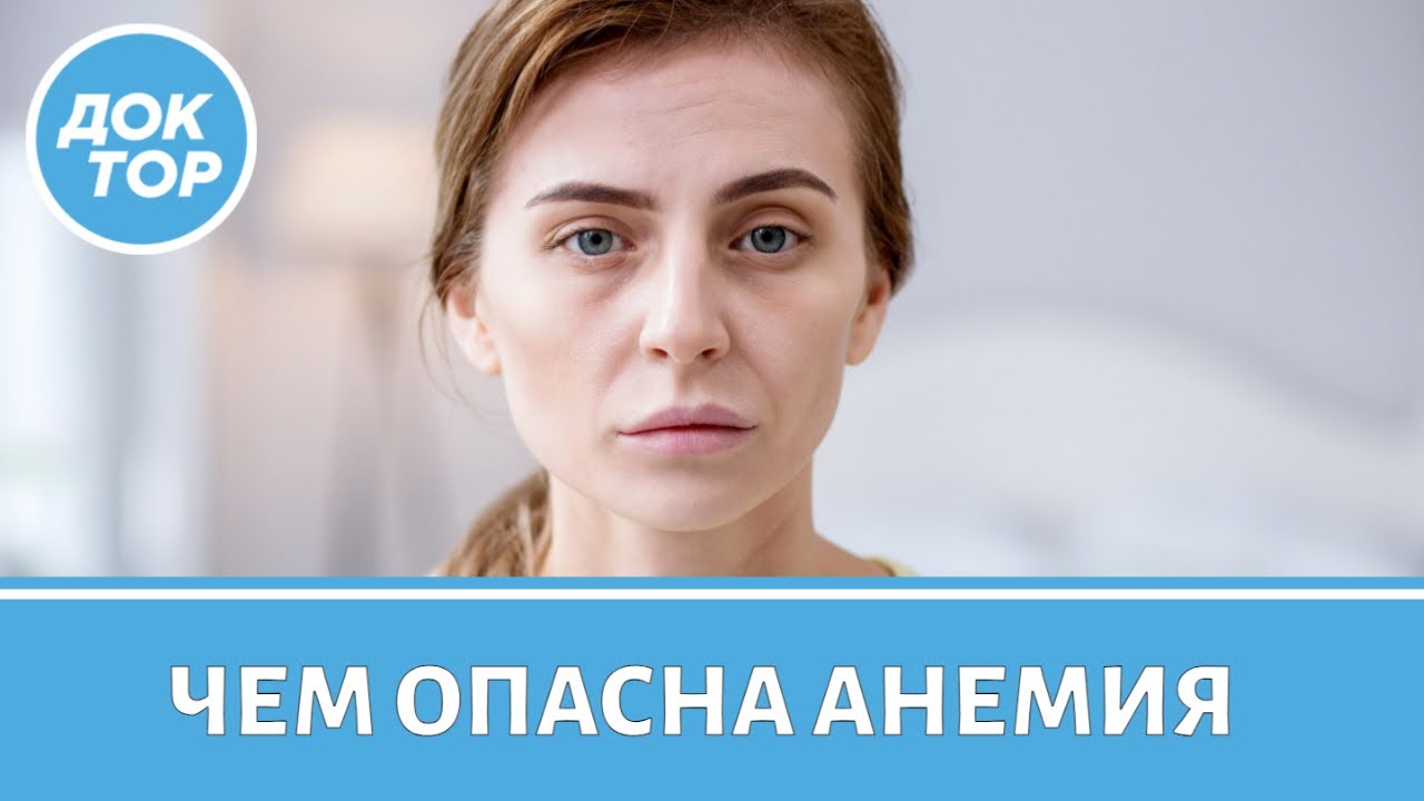 Анемия: симптомы, диагностика, лечение