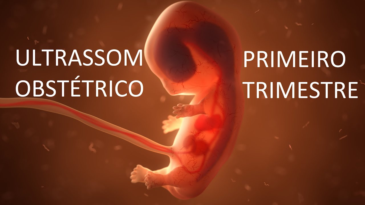 ULTRASSOM OBSTÉTRICO | PRIMEIRO TRIMESTRE
