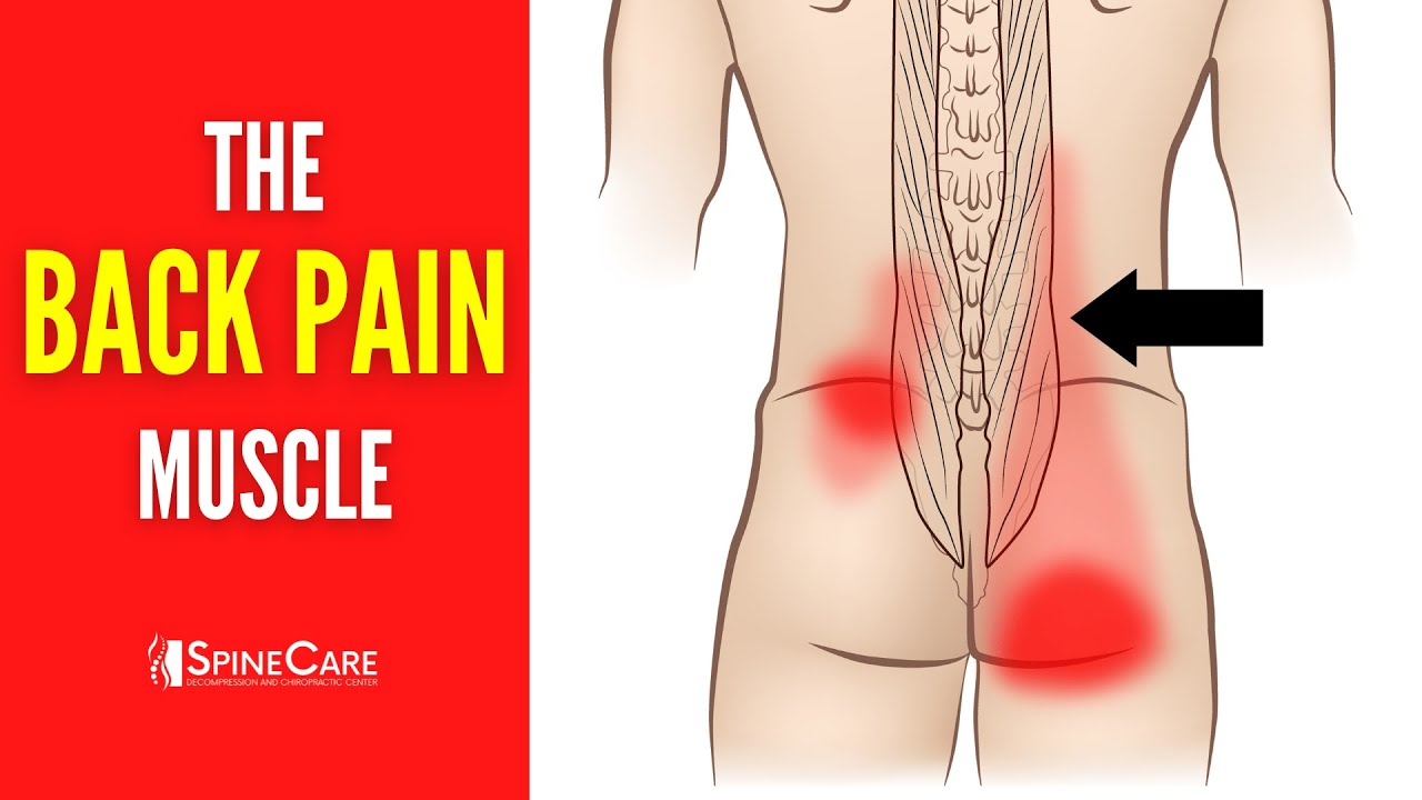 The Lower Back Pain Muscle (How to Release It for INSTANT RELIEF)