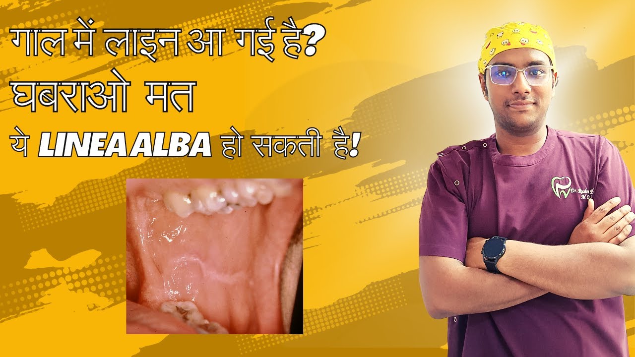 Dr Rudra Mohan | लिनिया अल्बा से घबराना बंद करिए, जानिए और समझिए | LINEA ALBA Simplified & Explained