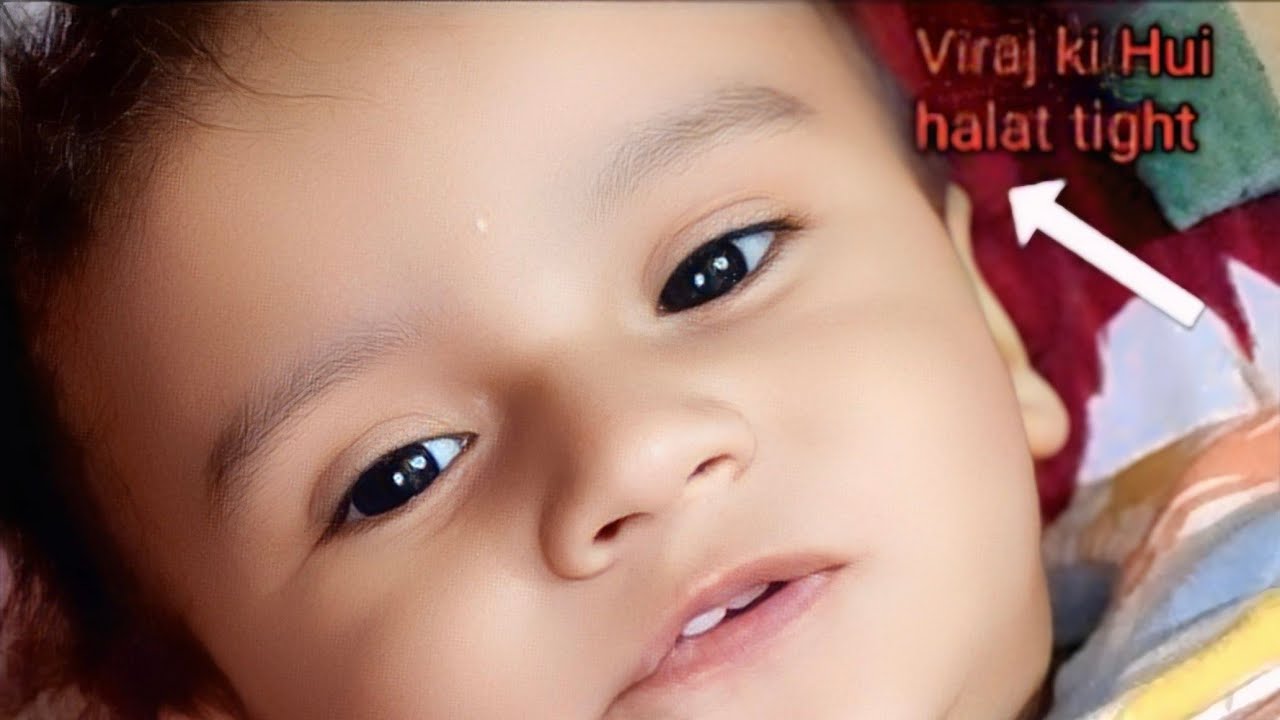 Pyaj ki Hui halat kharab 