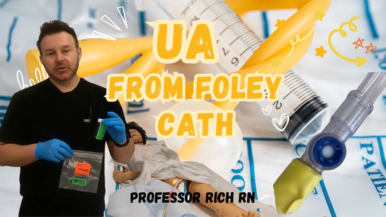 Избегайте этих ошибок при сборе мочи с помощью катетера Фолея.