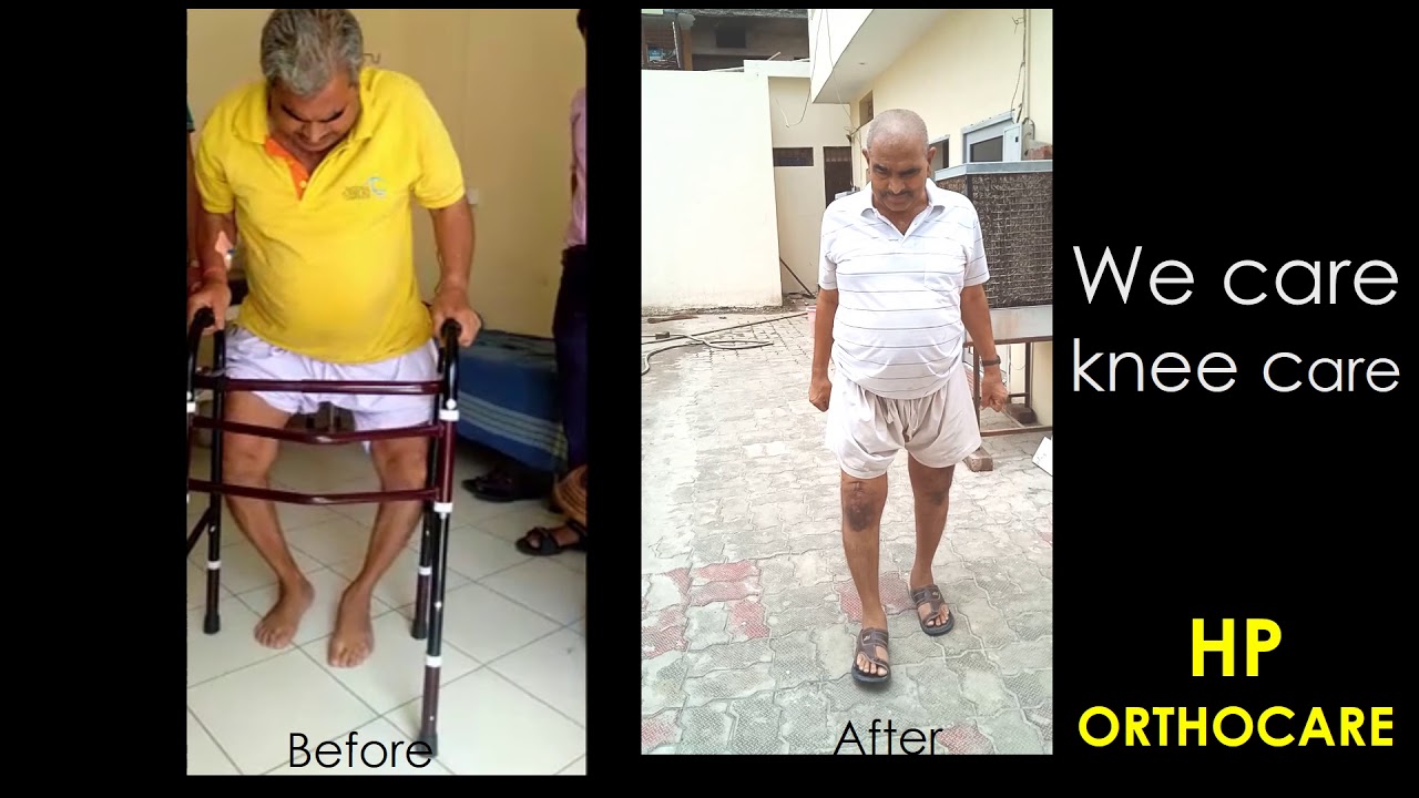 best knee replacement hospital punjab