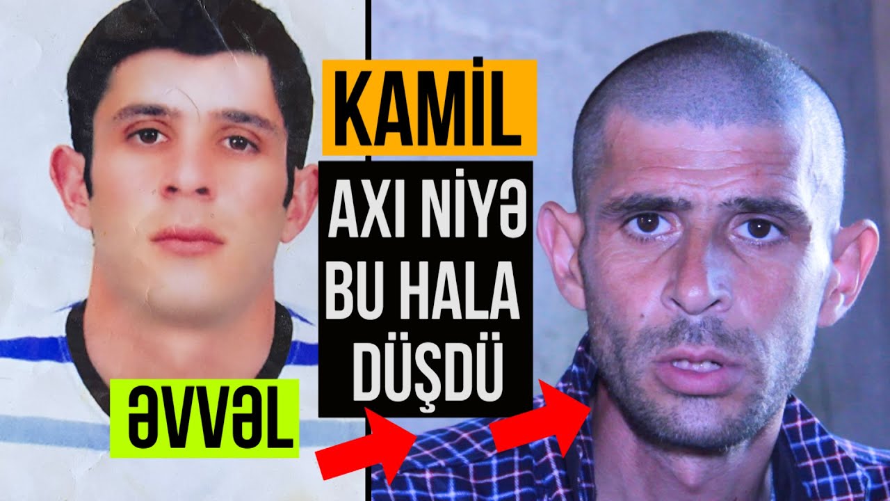 Nazirlərin evlərində olan sənətkarın yaşayışı, indiki halı hər kəsi dəhşətə gətirəcək - NARKOMANİYA