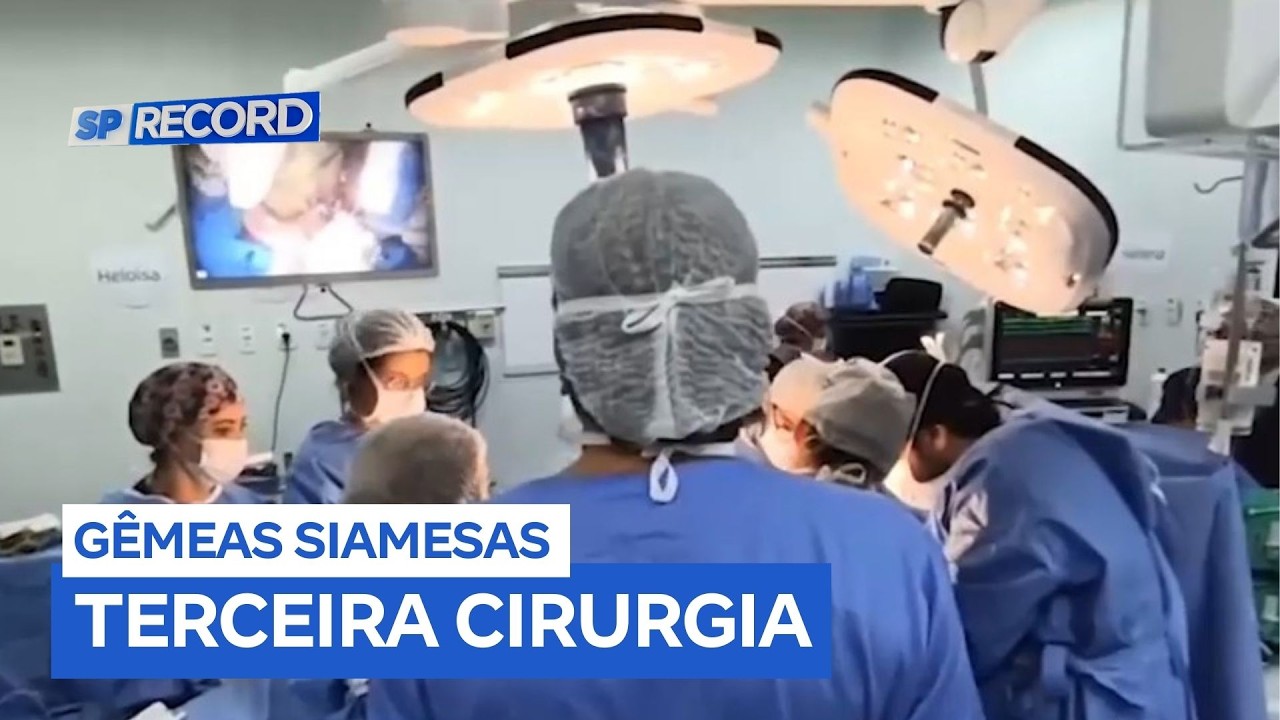 Gêmeas siamesas passam por terceira cirurgia de separação em Ribeirão Preto (SP)