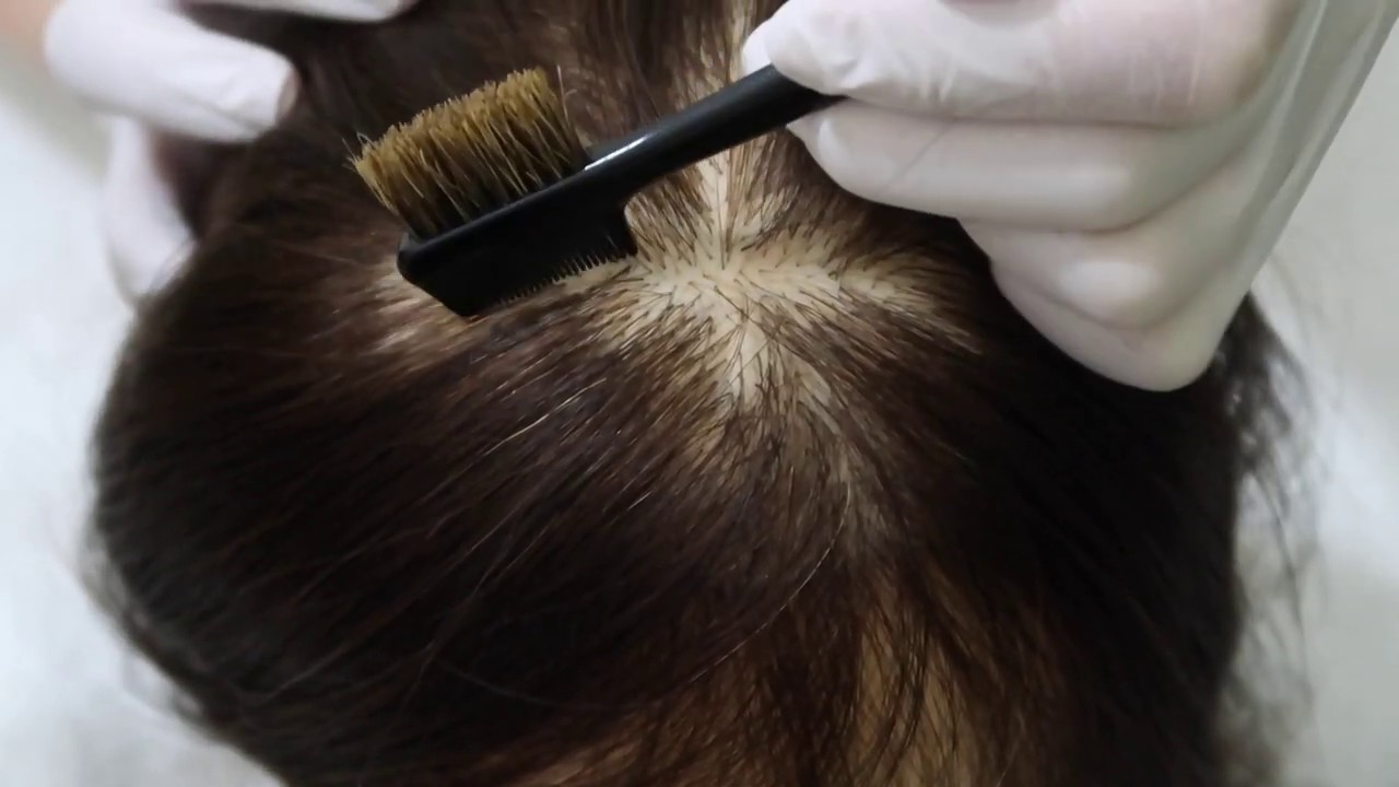 ASMR | Tingles Scalp Scratching | Stress Relief | Relaxing | No Talking
