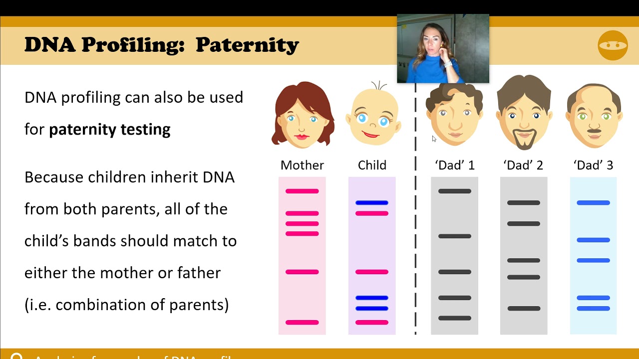 3.5 part 1 - IB Biology - Gene Expression