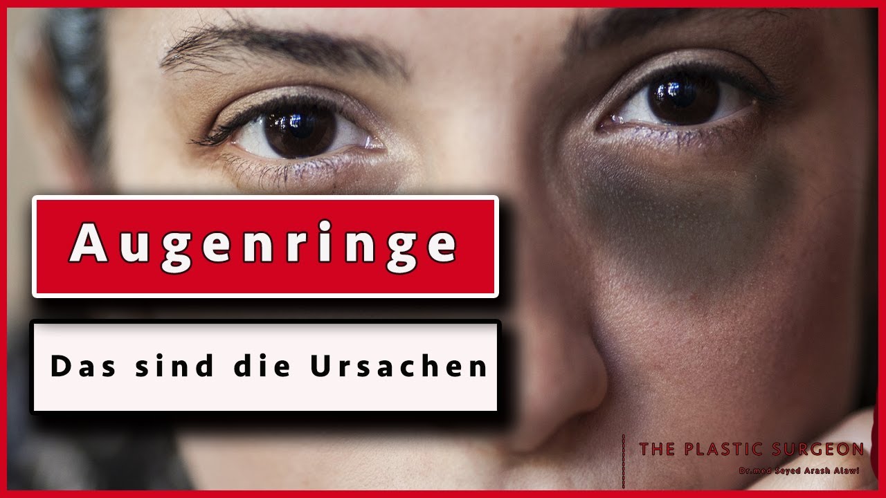 Was sind die URSACHEN für Augenringe und dunkle Augenschatten? Plastische Chirurgie | Dr. Alawi