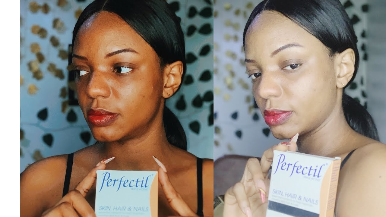 Perfectil Best Review (Skin, Hair, Nails) Vita biotic skin supplement
