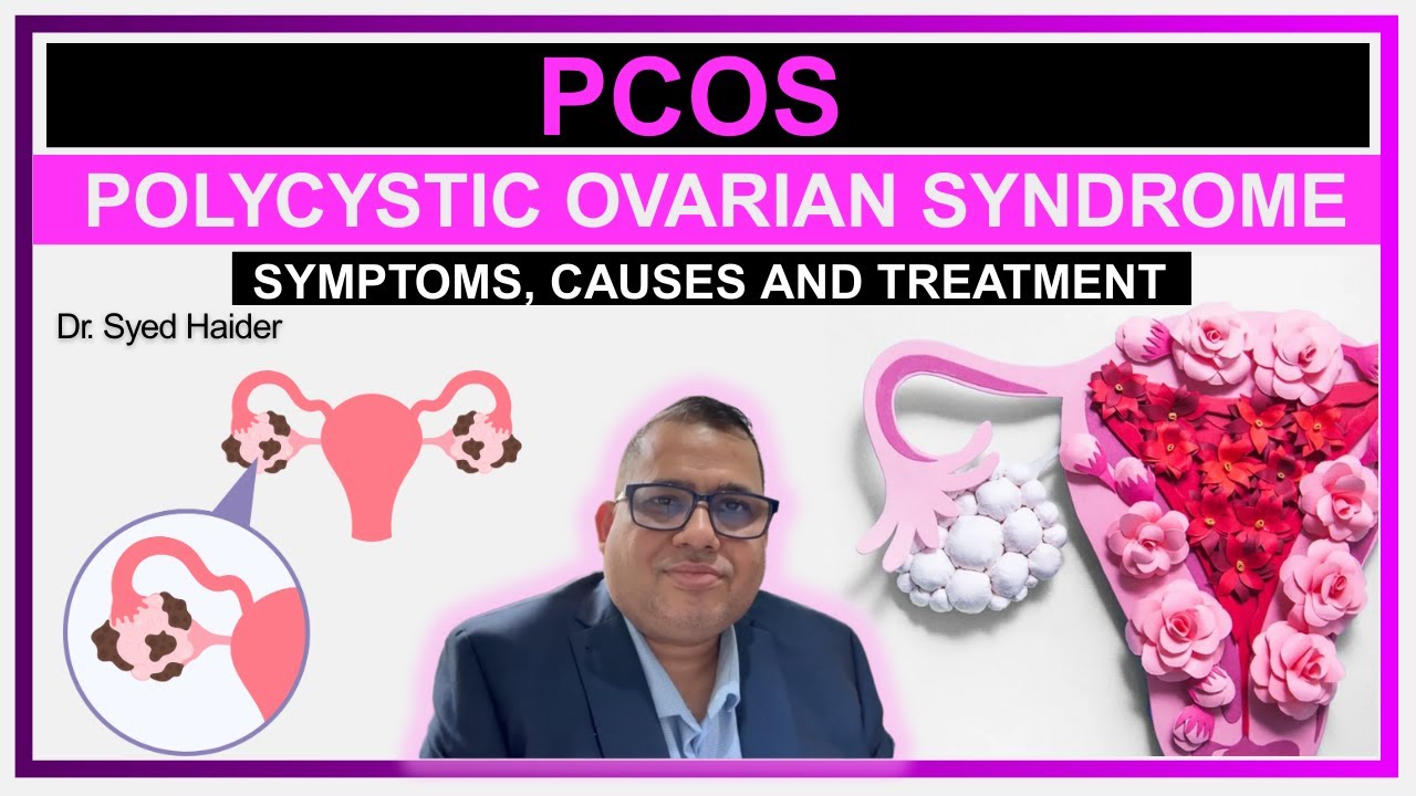 #polycysticovarysyndrome syndrome