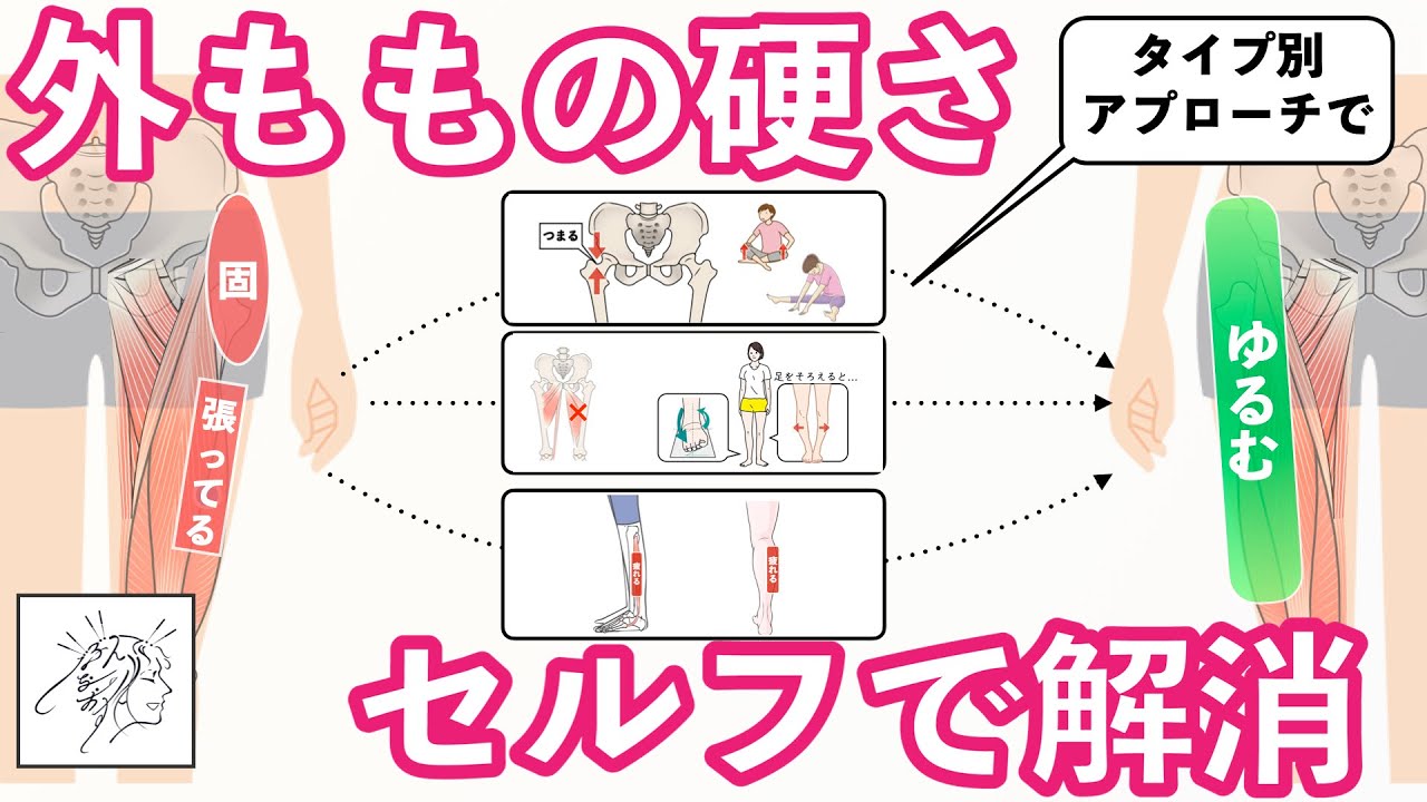 【外もも硬い】タイプ別のセルフケアまとめ｜①股関節硬い②内転筋弱い・外側体重③スネの外側疲れる