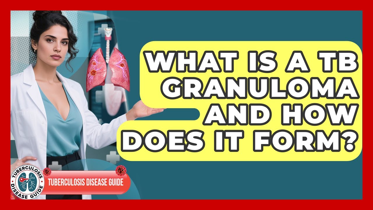 What Is A TB Granuloma And How Does It Form? - Tuberculosis Disease Guide