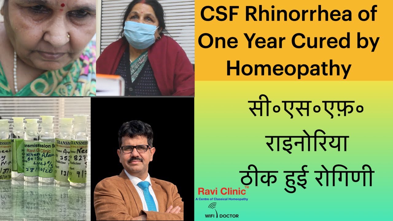 CSF Rhinorrhea of One Year Cured by Homeopathy