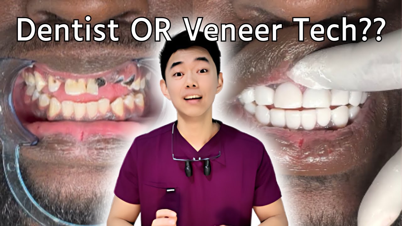 Veneer Tech Composite Veneers - Risks and Benefits (Dentist REACTS)