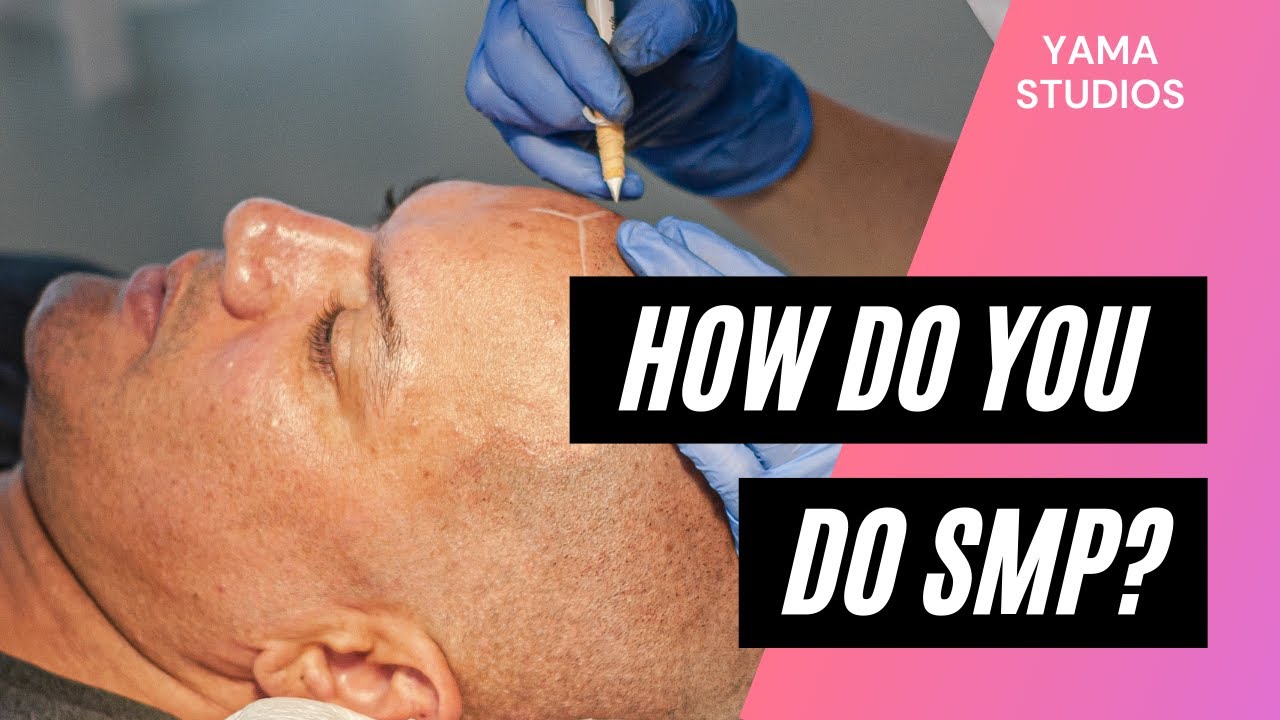 How Do You Do Scalp Micropigmentation? SMP Explained