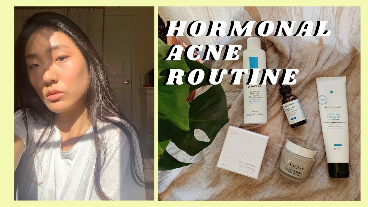 Products that CLEARED my Congested Skin | SkinCeuticals, LaRoche Posay, Vichy + more!