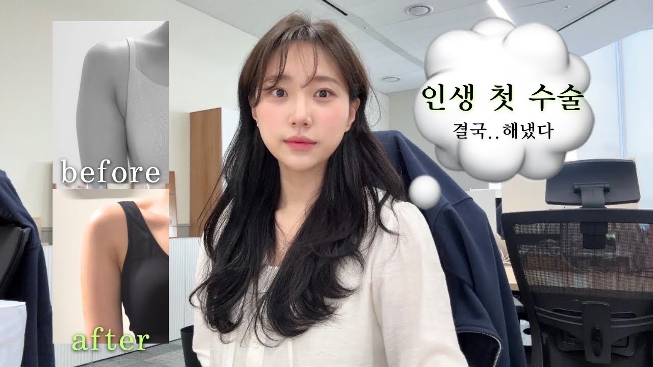 첫 수술 후기 낋여옴..♨️ㅣ팔 지방흡입 후기(당일~2주차)ㅣ지흡 붓기.통증.부작용ㅣ지흡 고민이거나 수술 예정이신분들 간접체험ㄱㄱ..⭐︎ㅣ지흡 후 출근?ㅣ지방흡입 당일 브이로그