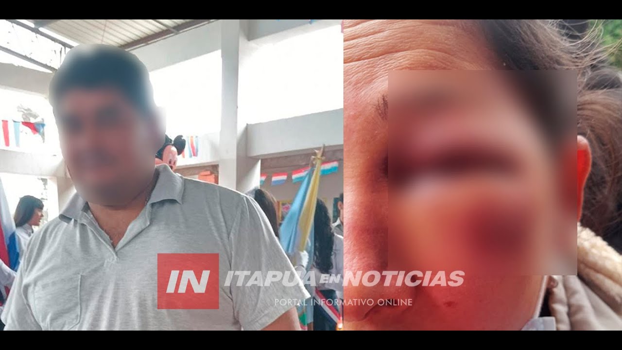 HOMBRE HABRÍA GOLPEADO BRUTALMENTE A SU PAREJA EN CAMBYRETÁ
