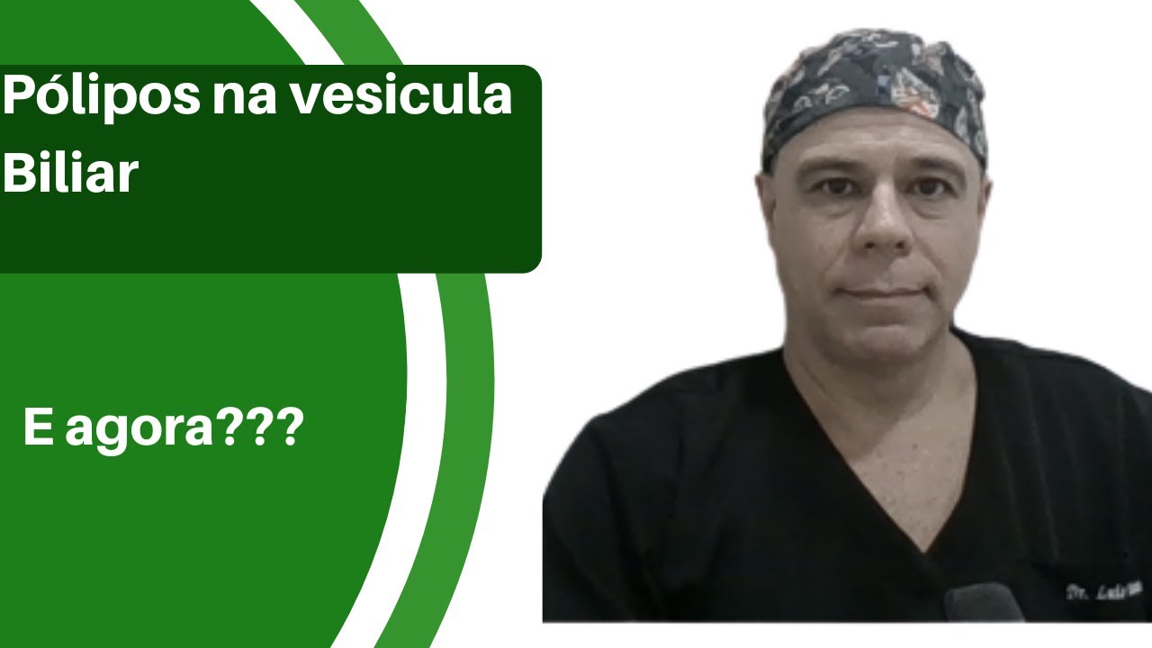 Pólipos na vesícula biliar. E agora?