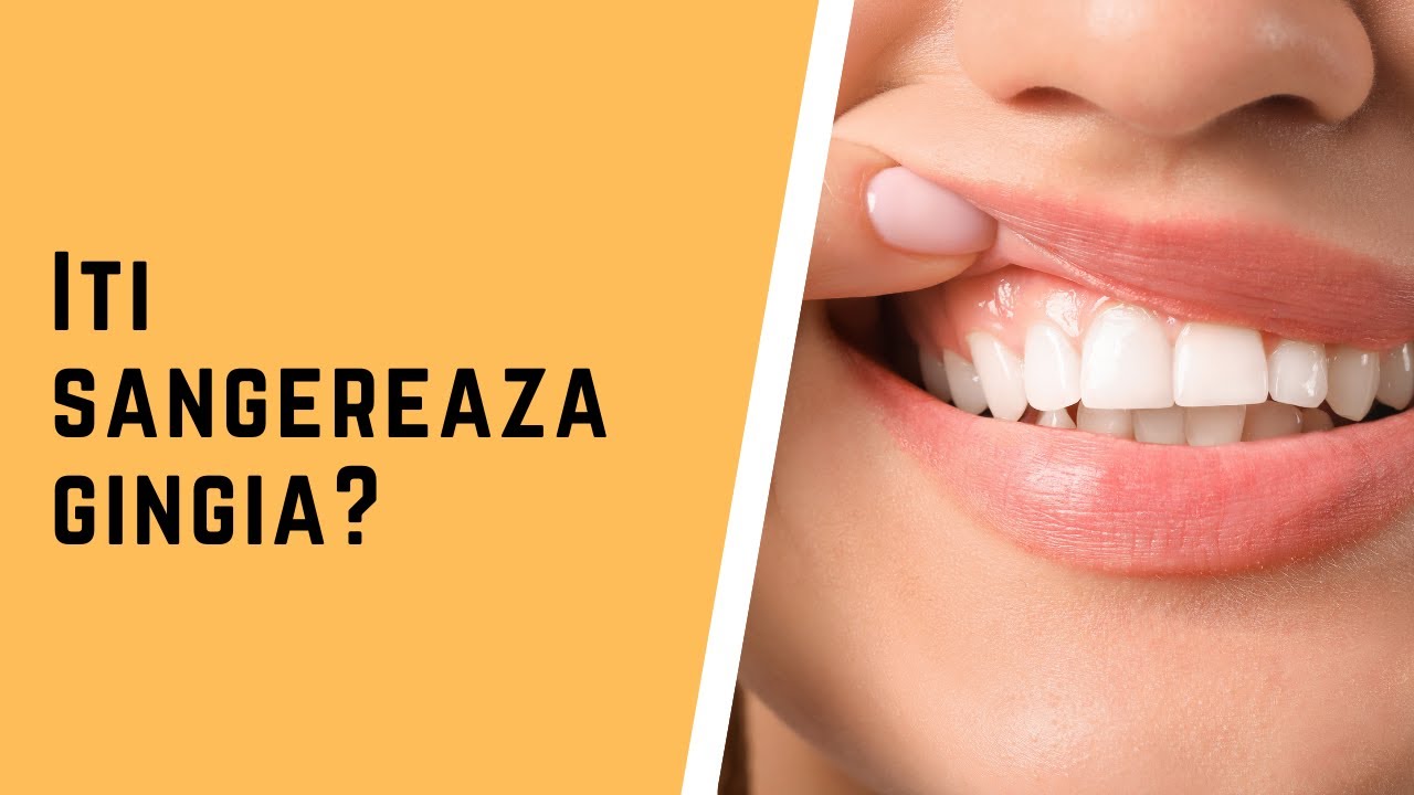 Iti sangereaza gingiile?
