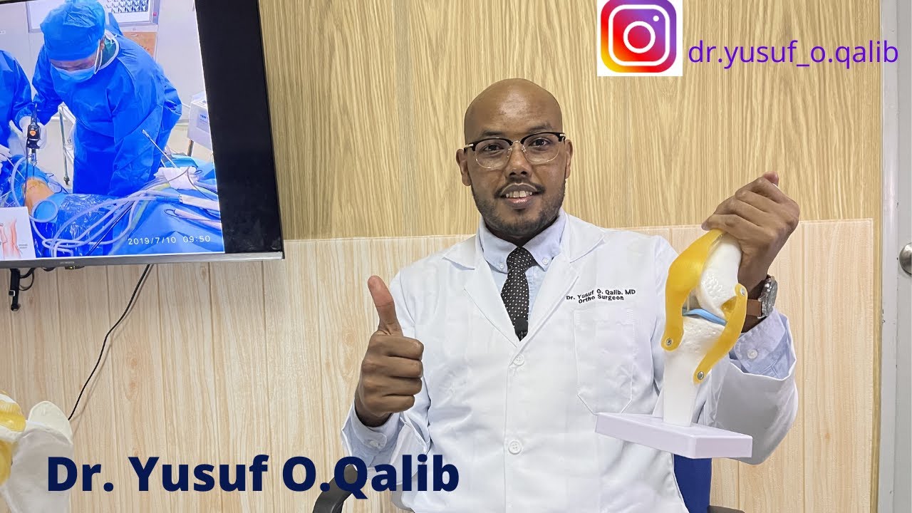 Waa maxay Barkinta Ruuga ama Jilibka (Meniscus) sidee se loogu tolaa arthroscopy ga Jilibka!