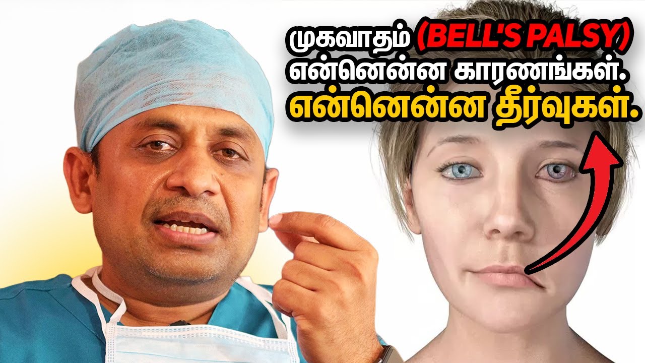 முகவாதம் (BELL'S PALSY)என்னென்ன காரணங்கள்.. என்னென்ன தீர்வுகள். | Dr Prabhu