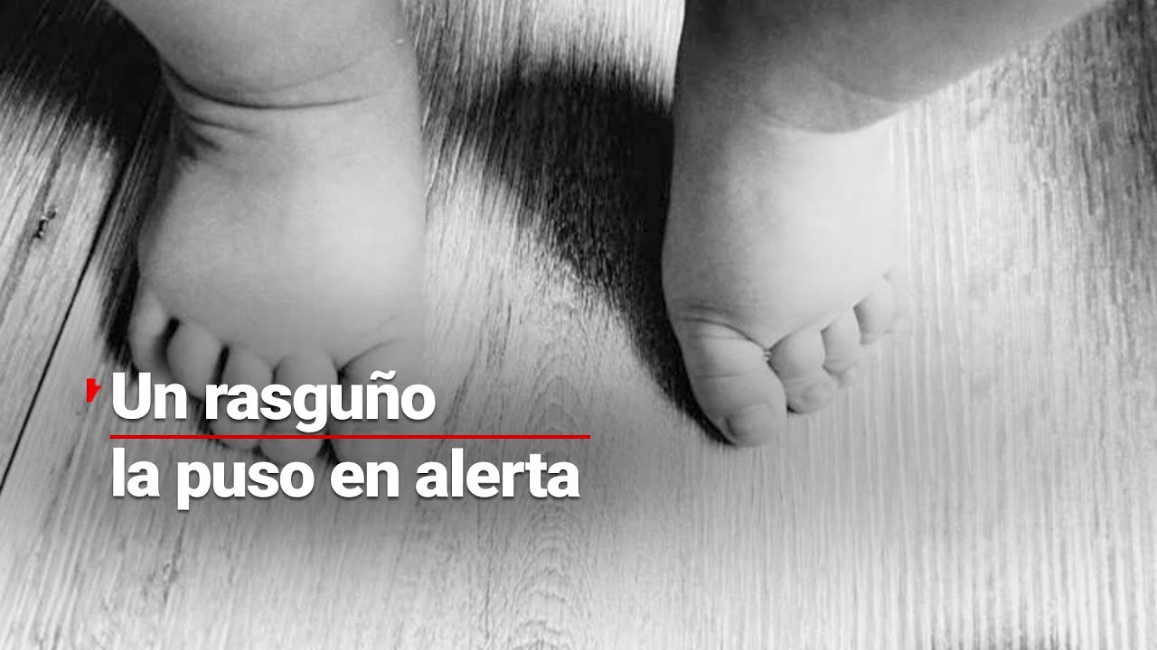 Un rasguño la puso alerta | ENTREVISTA con la madre de menor de un año que sufrió abuso en guardería