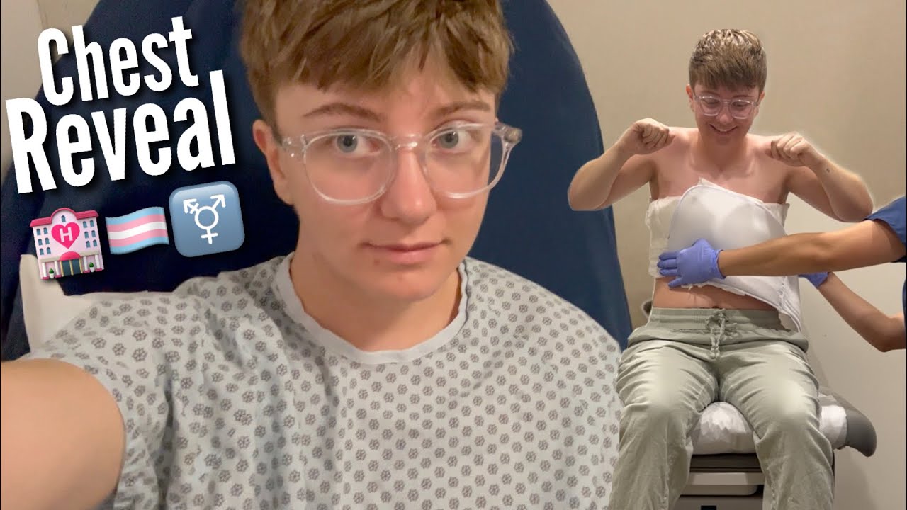 i vlogged my top surgery | FTM Transition