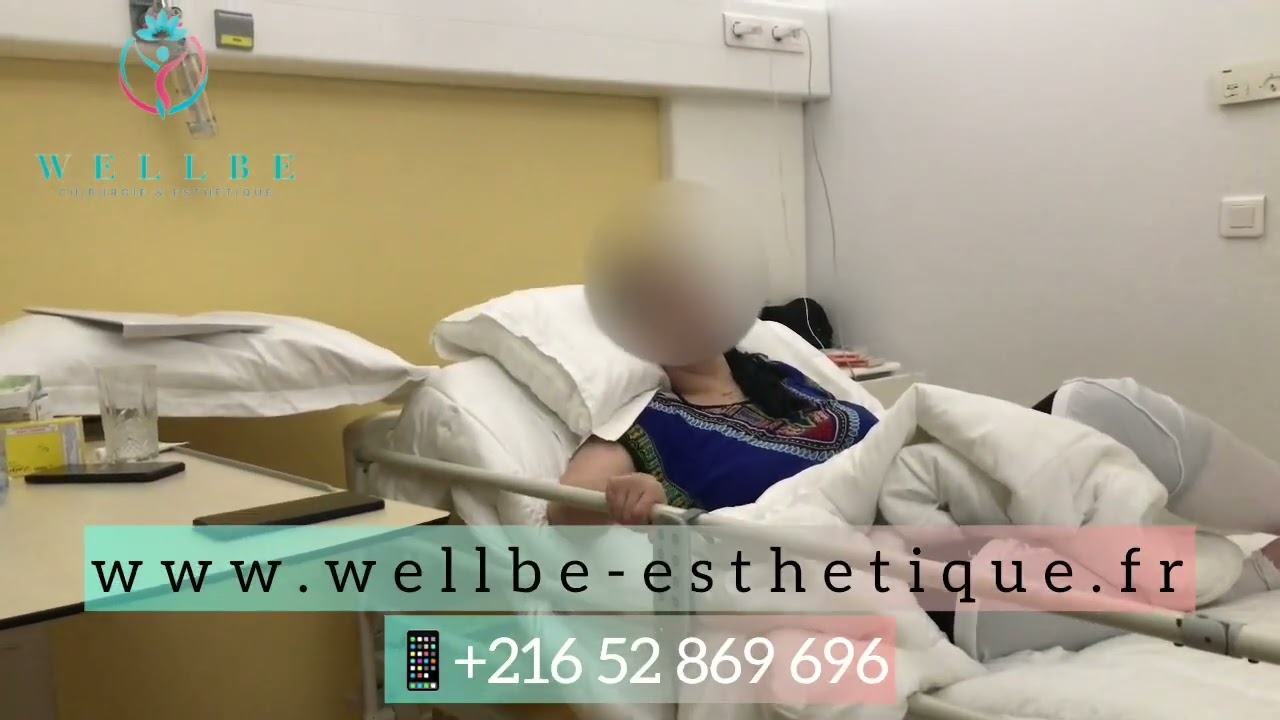 Body lift - Témoignage - WellBe Esthétique