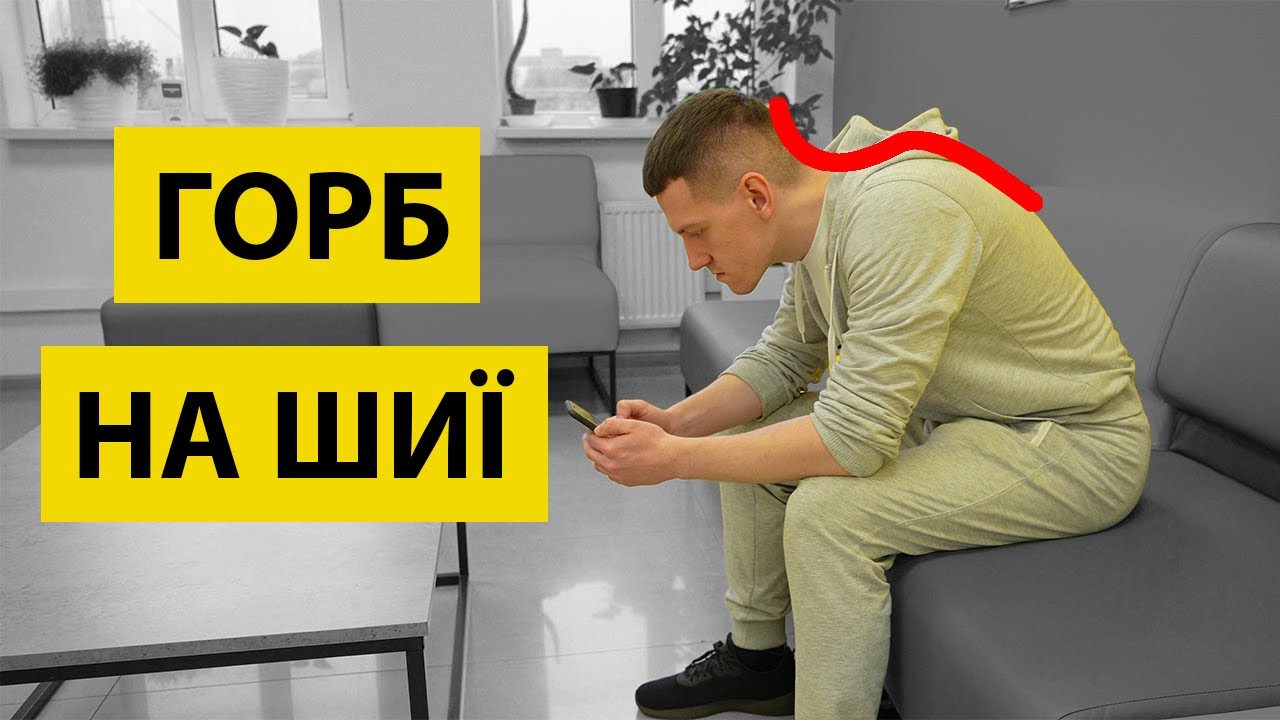 Вдовиний горб  Як забрати горб на шиї  Комплекс вправ