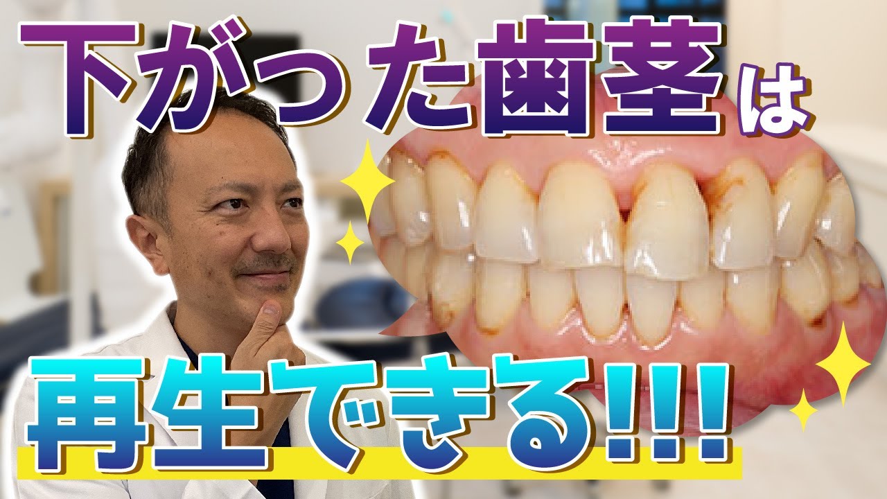 下がった歯茎は再生できる！！！