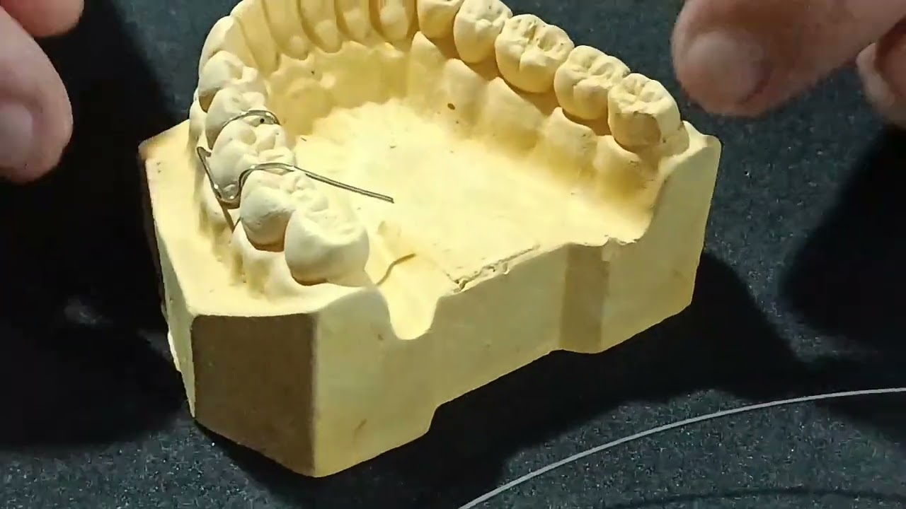 Retenedor Adams - (Dr. Cesar Cortez Sosa)