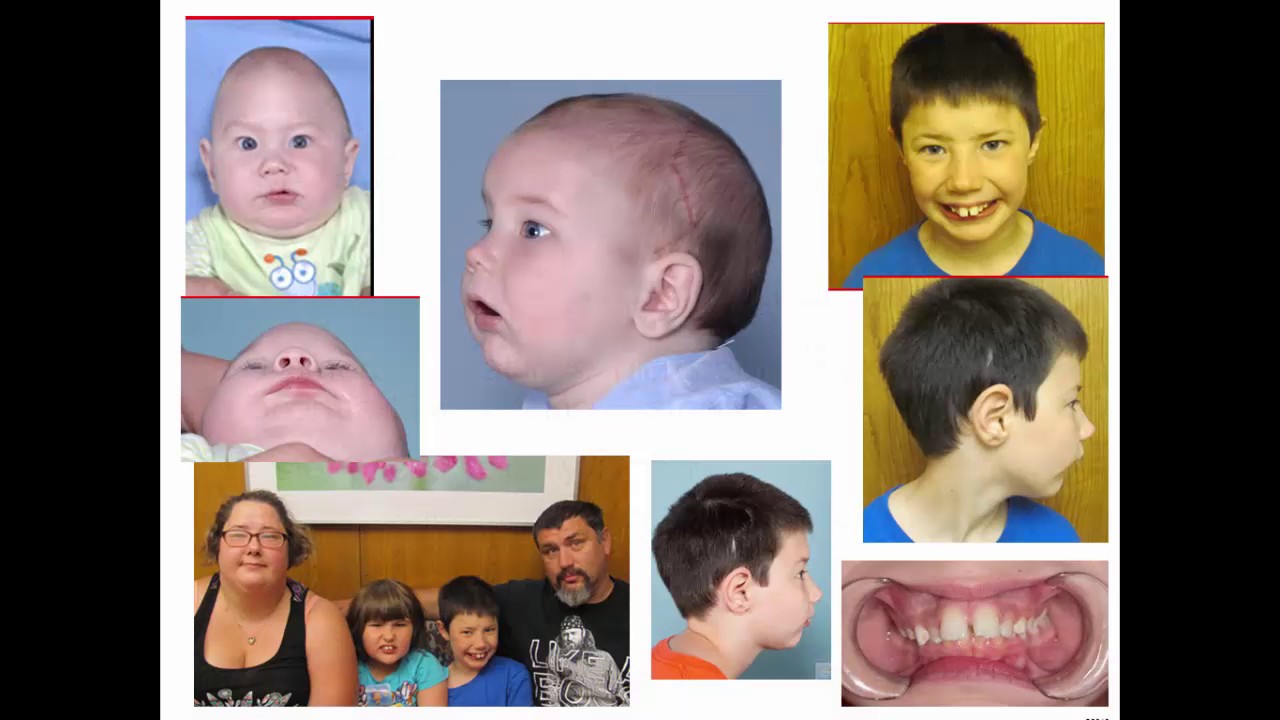 Profiles in Genetics: The Patient Perspective: Diagnostic Exome Sequencing