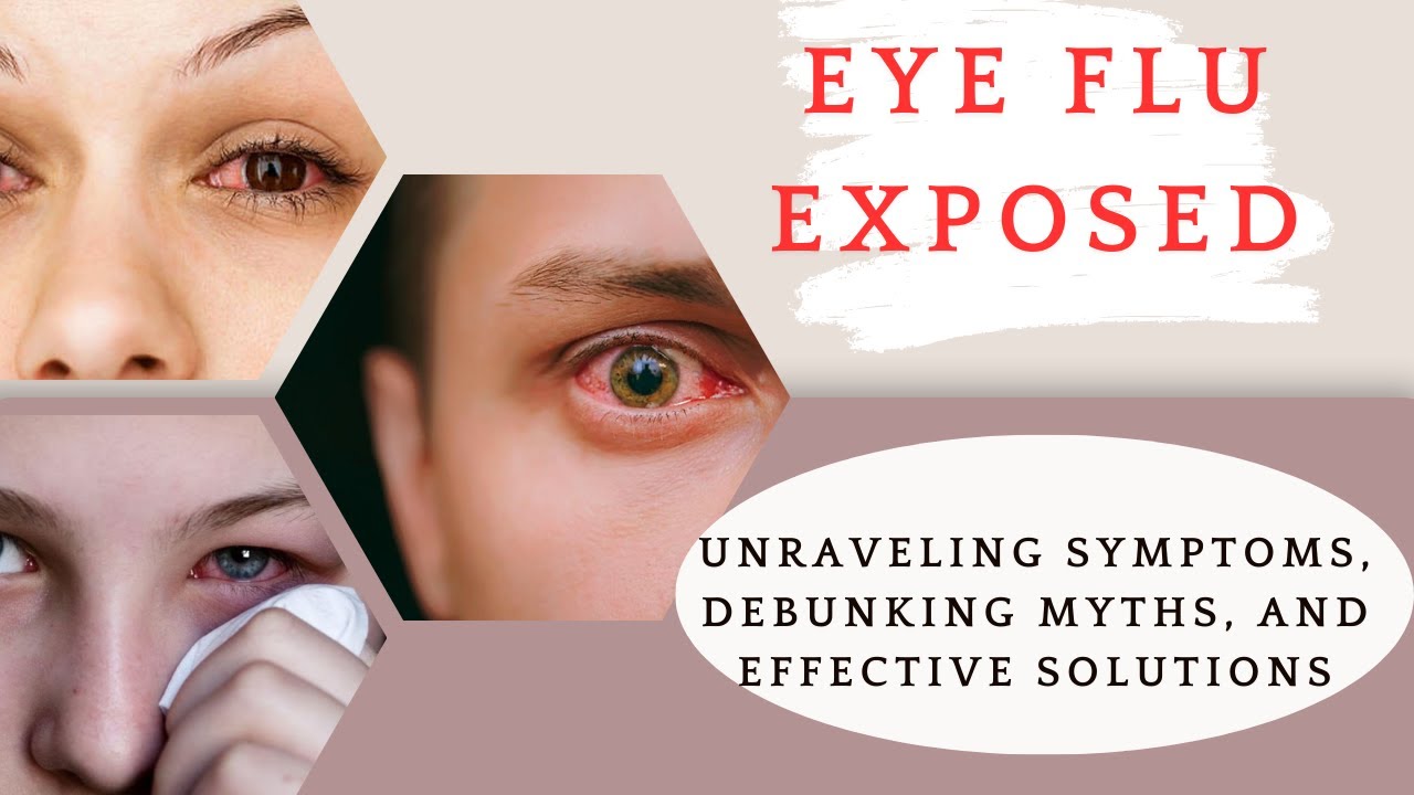 Eye Flu Exposed: Unraveling Symptoms, Debunking Myths, and Effective Solutions 🤘
