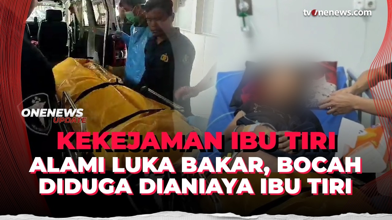 Tragis Badan Penuh Luka Bakar, Bocah di Sukabumi Diduga Meninggal Dianiaya Ibu Tiri | OneNews Update