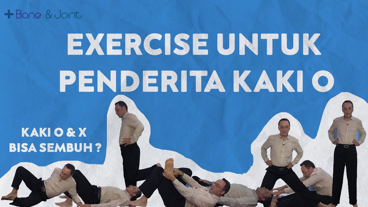 Kaki O bisa sembuh? - Excercise Penderita Kaki O