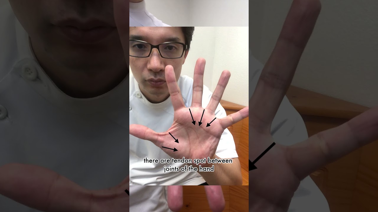 Spoon Technique for Trigger Finger (Part 3) on the Base of the Fingers #triggerfinger #triggerthumb