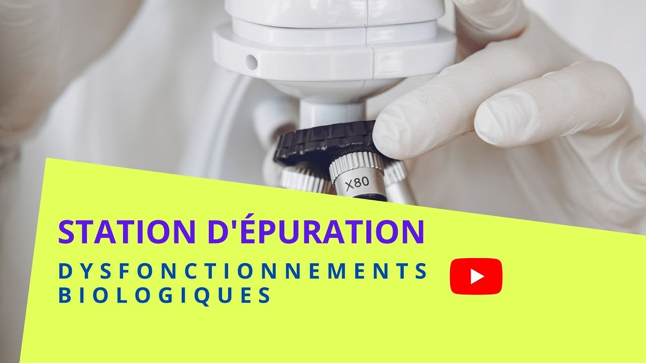 Les Dysfonctionnements Biologiques des Stations d’épuration: Quelques Recommandations