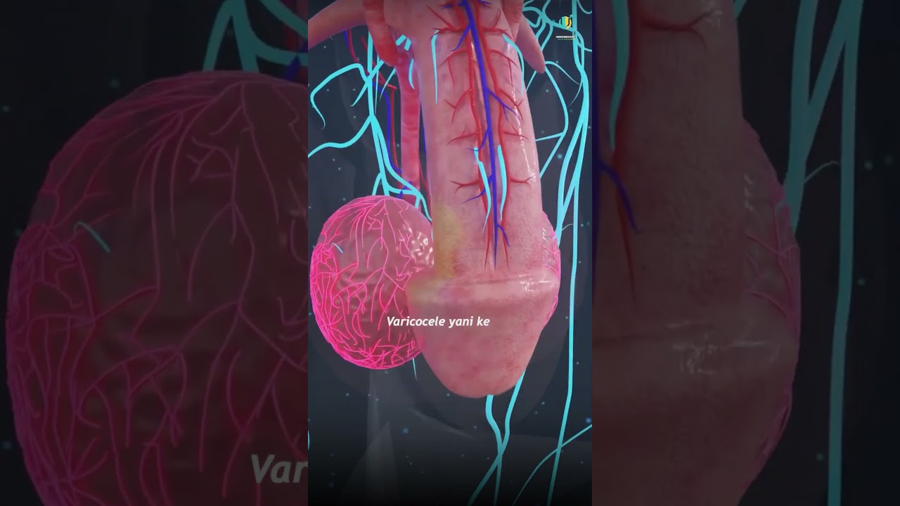 Testicular Pain Causes | अंडकोष में दर्द के लक्षण और कारण | Dr. Irfan Shaikh #testicularpain