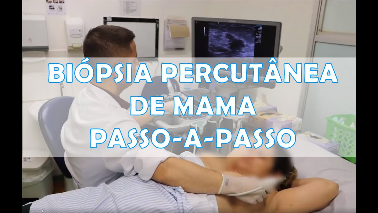 Bi&oacute;psia percut&acirc;nea de fragmento de n&oacute;dulo de mama guiada pela ultrassonografia
