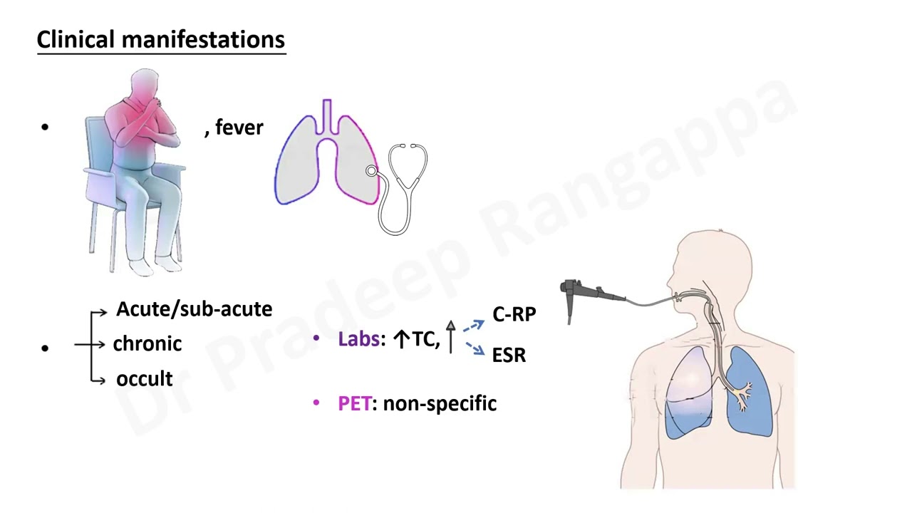 Onco-intensive Care_CIP (Check-point Inhibitor Pneumonitis)